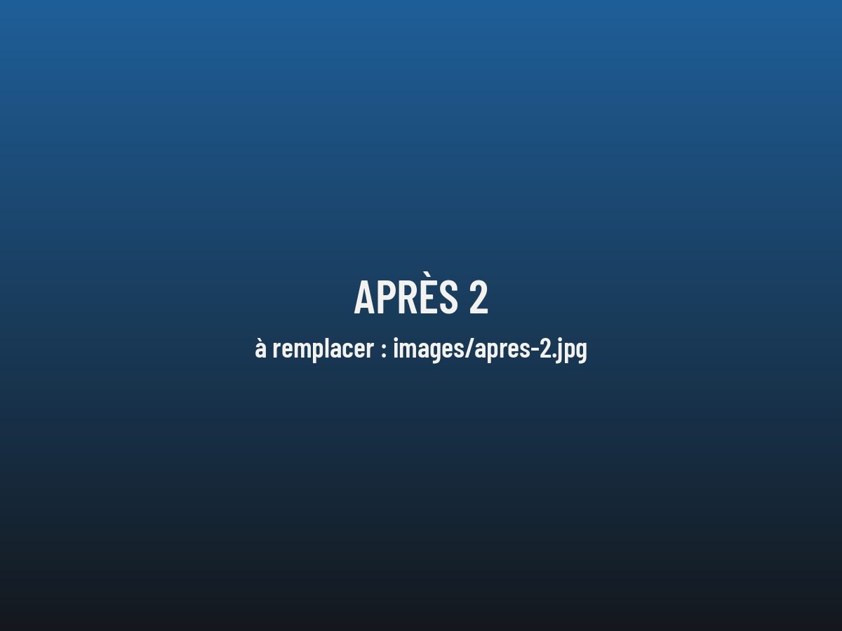 Après, véhicule 2